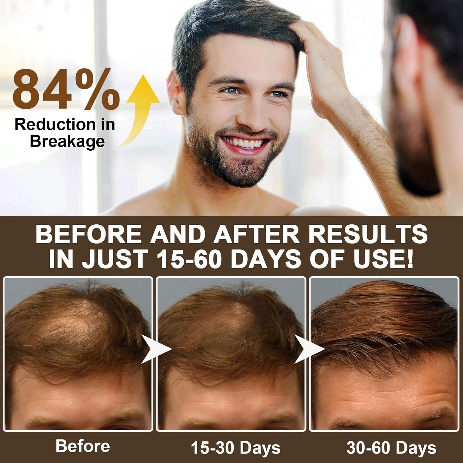 Caffeine Shampoo Cleanses Scalp, Promotes Natural Hair Growth - Men'S Scalp Tonic for Thinning Hair