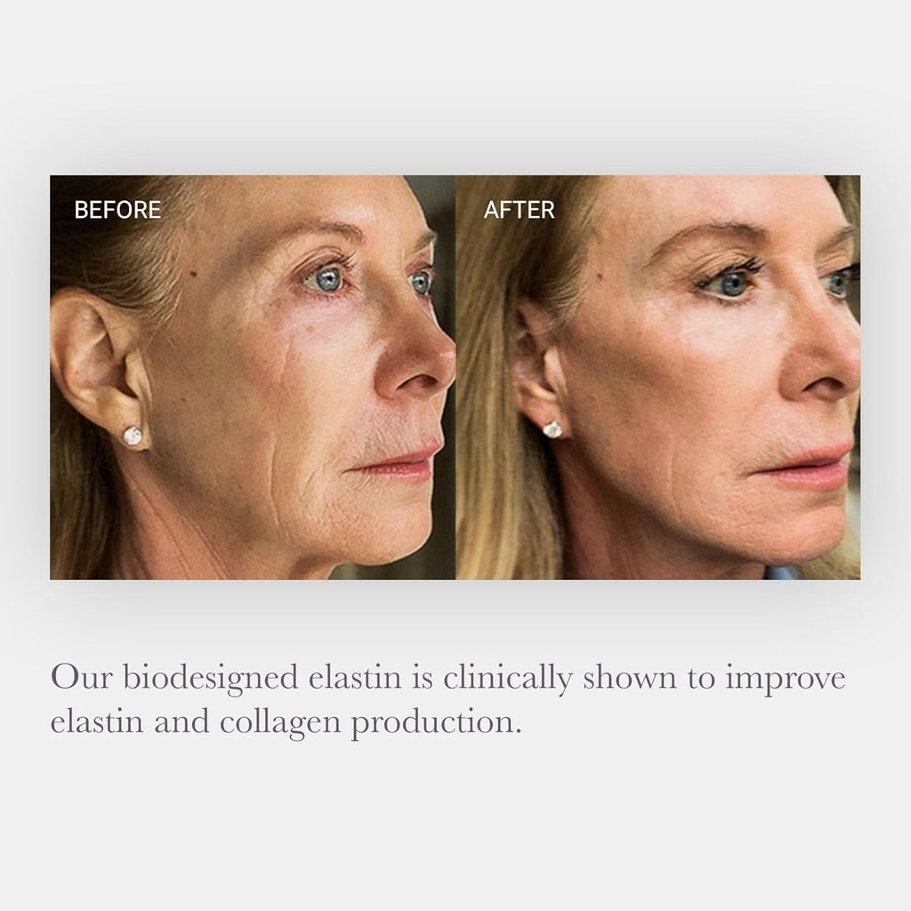 Elastaplex & Hyaluronic Acid Serum for Face, Lips & Décolleté - SKIN Intensive Hydrating Serum - Promote Dewy Radiance in Aging Skin (0.5 Oz)